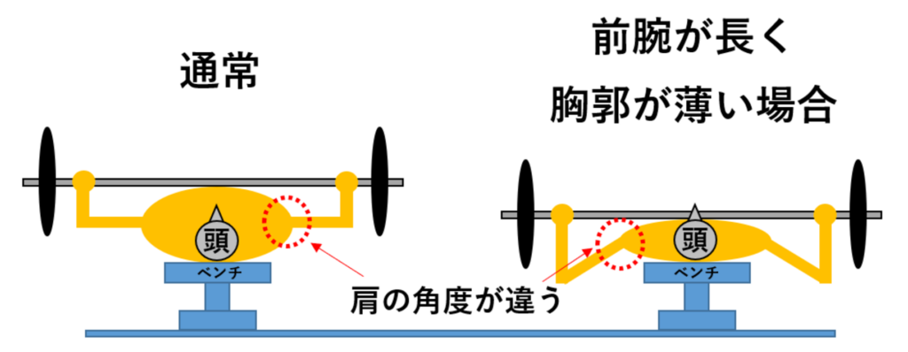 前腕が長く胸郭が薄い説明